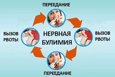 Лечение булимии в Селятино